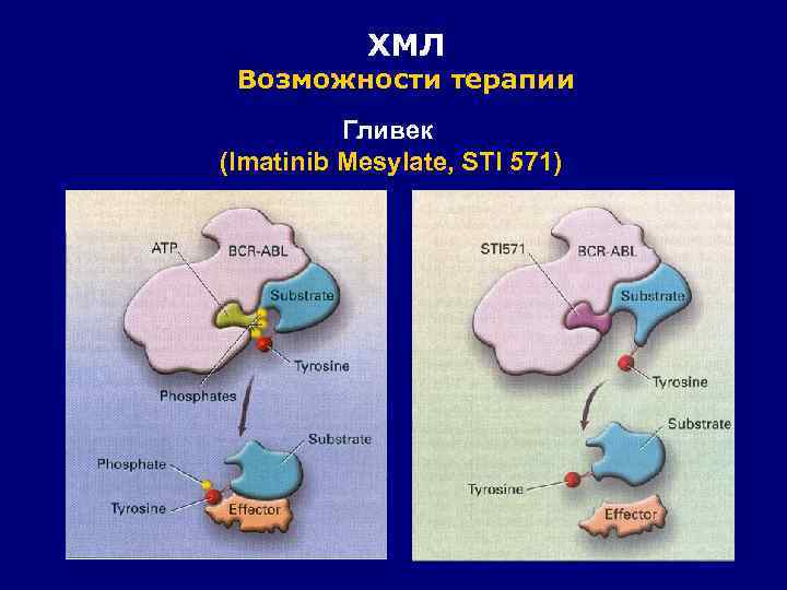 ХМЛ Возможности терапии Гливек (Imatinib Mesylate, STI 571) 