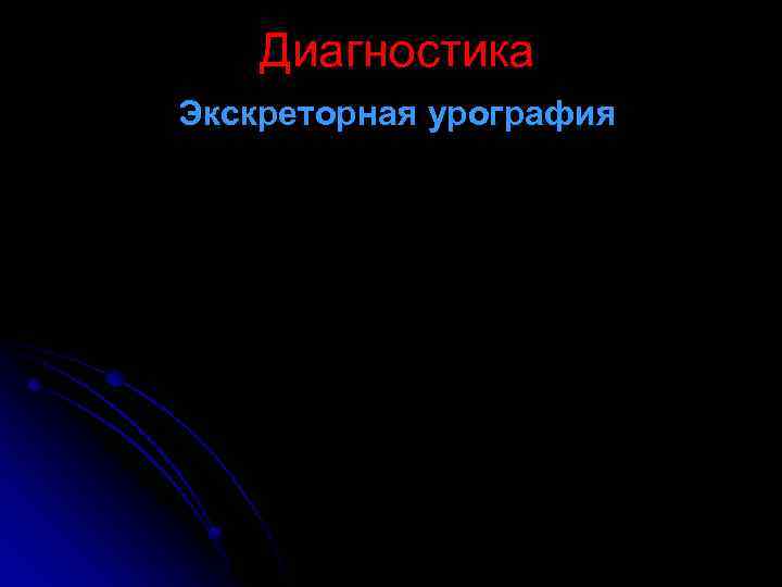 Диагностика Экскреторная урография 