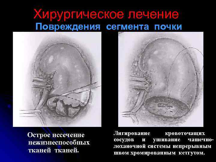 Обнаружено повреждение в структуре файловой системы на томе в