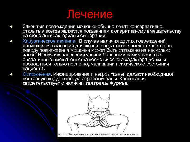 Лечение l l l Закрытые повреждения мошонки обычно лечат консервативно, открытые всегда являются показанием