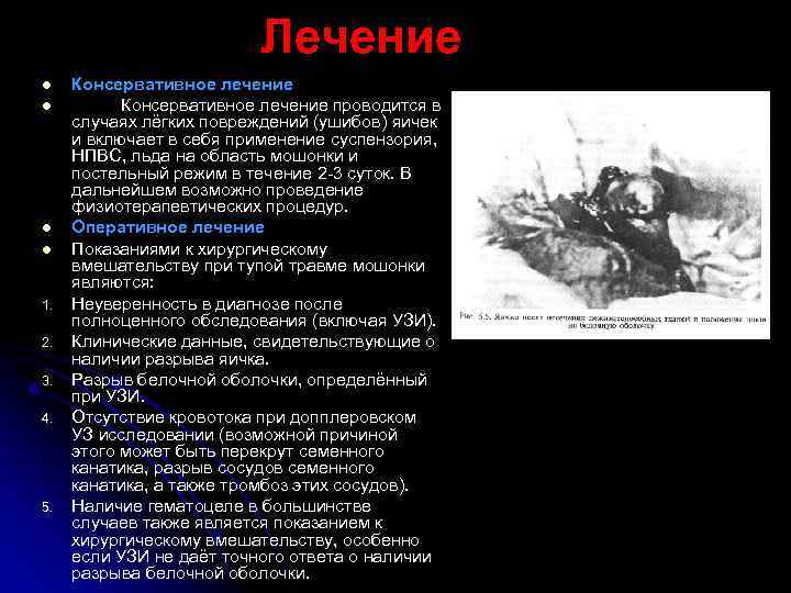 Лечение l l 1. 2. 3. 4. 5. Консервативное лечение проводится в случаях лёгких