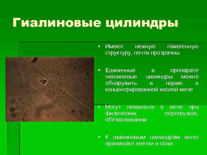 Гиалиновые цилиндры Имеют нежную гомогенную структуру, почти прозрачны Единичные в препарате гиалиновые цилиндры можно