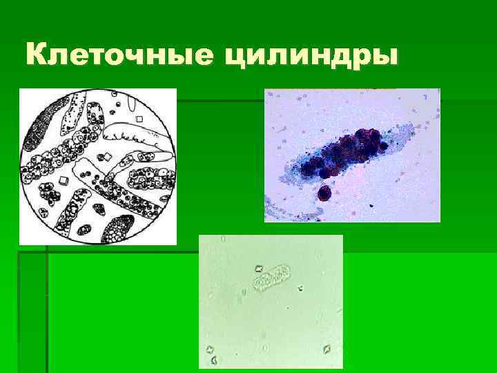 Клеточные цилиндры 