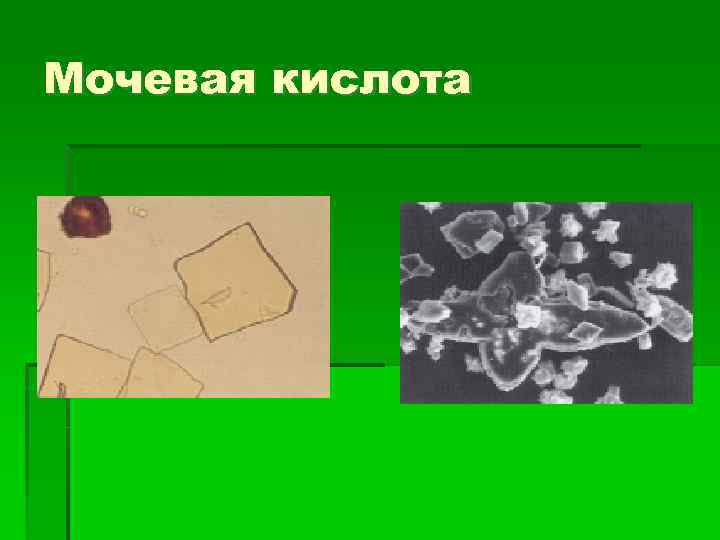 Мочевая кислота 