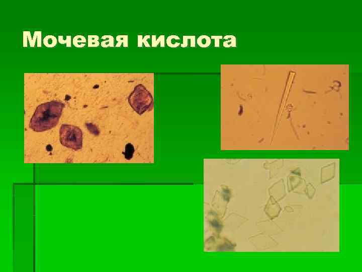 Мочевая кислота 