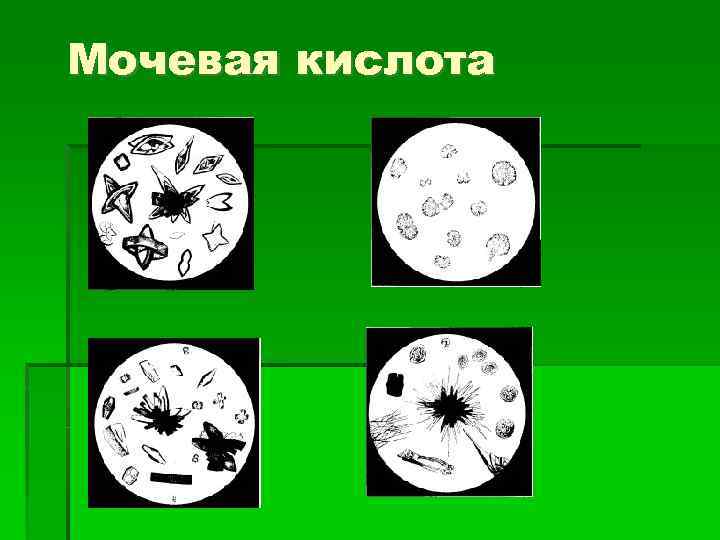 Мочевая кислота 