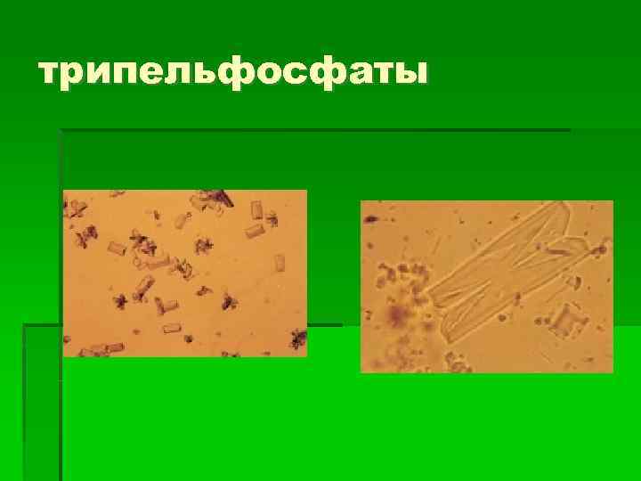 трипельфосфаты 