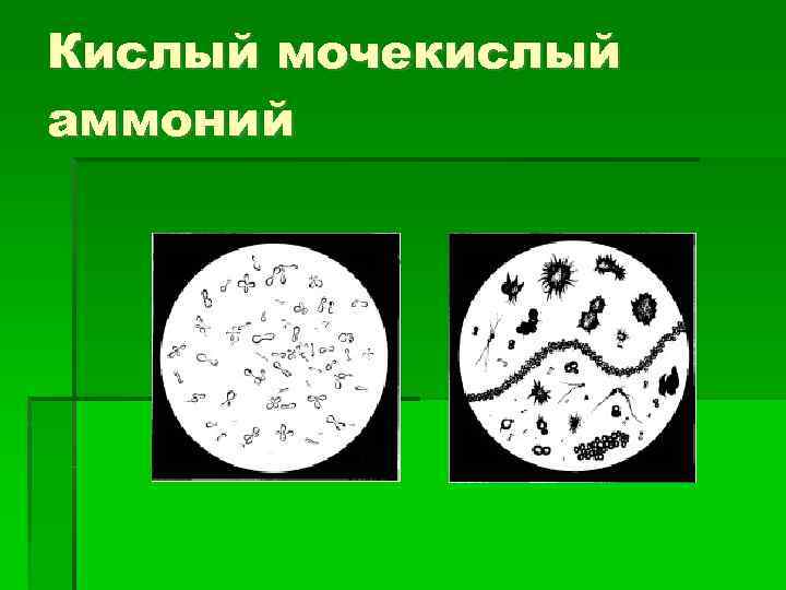 Кислый мочекислый аммоний 