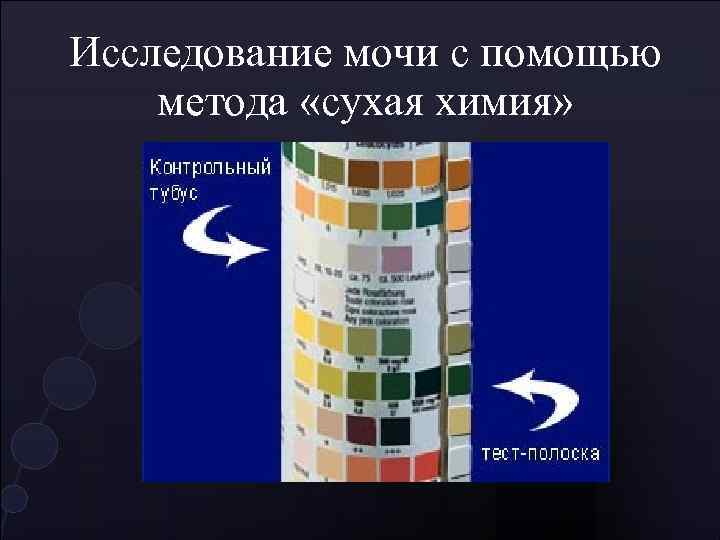 Исследование мочи с помощью метода «сухая химия» 