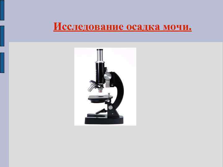 Исследование осадка мочи. 