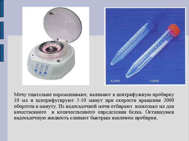 Мочу тщательно перемешивают, наливают в центрифужную пробирку 10 мл и центрифугируют 5 -10 минут