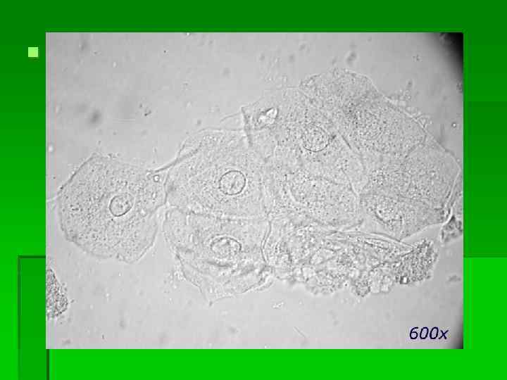  Почечный эпителий 