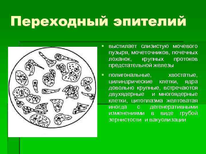 Переходный эпителий выстилает слизистую мочевого пузыря, мочеточников, почечных лоханок, крупных протоков предстательной железы полигональные,