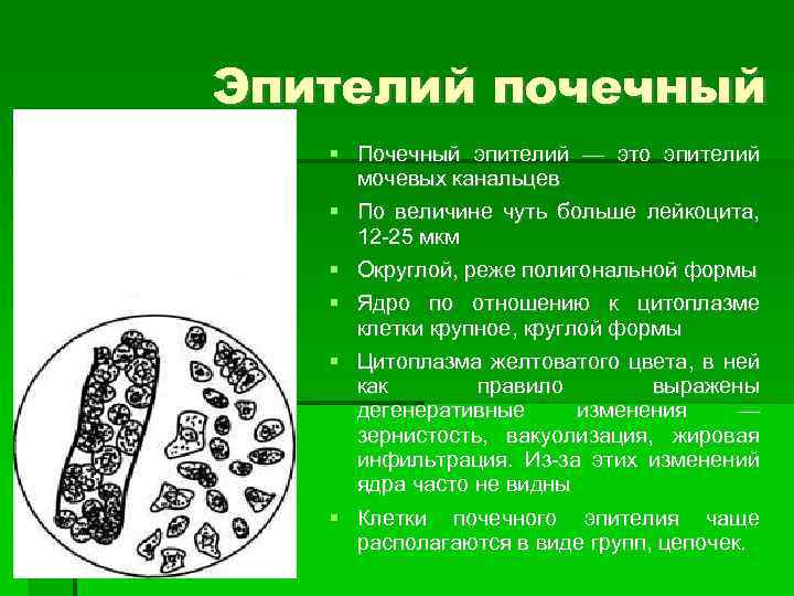 Эпителий почечный Почечный эпителий — это эпителий мочевых канальцев По величине чуть больше лейкоцита,