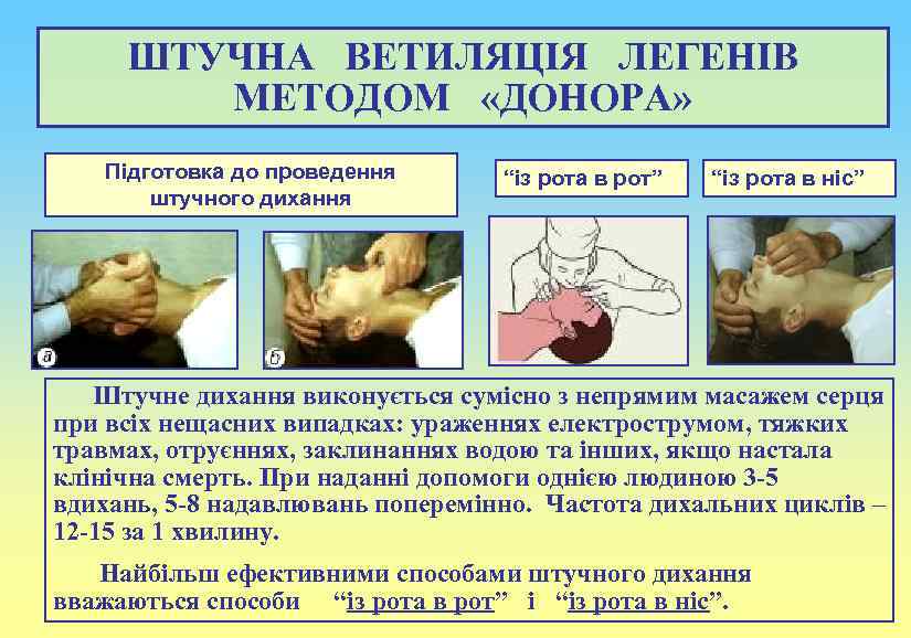 ШТУЧНА ВЕТИЛЯЦІЯ ЛЕГЕНІВ МЕТОДОМ «ДОНОРА» Підготовка до проведення штучного дихання “із рота в рот”
