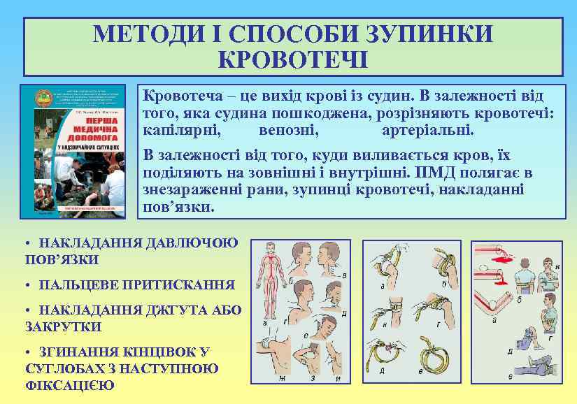МЕТОДИ І СПОСОБИ ЗУПИНКИ КРОВОТЕЧІ Кровотеча – це вихід крові із судин. В залежності