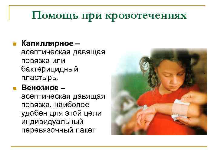 Помощь при кровотечениях n n Капиллярное – асептическая давящая повязка или бактерицидный пластырь. Венозное