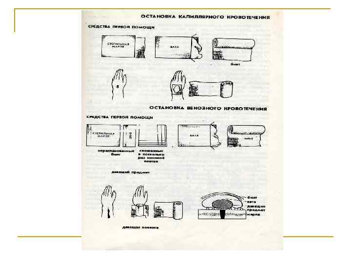 Помощь при кровотечениях: n n n Артериальное – это самое опасное кровотечение, т к