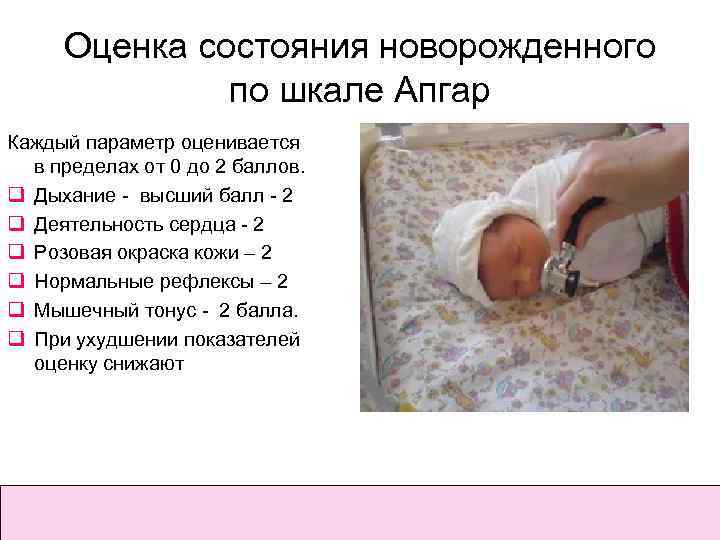 Оценка состояния новорожденного по шкале Апгар Каждый параметр оценивается в пределах от 0 до