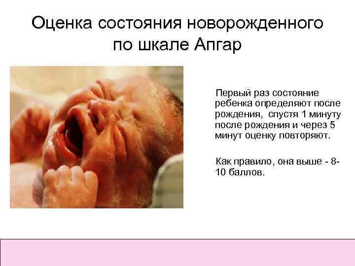Оценка состояния новорожденного по шкале Апгар Первый раз состояние ребенка определяют после рождения, спустя