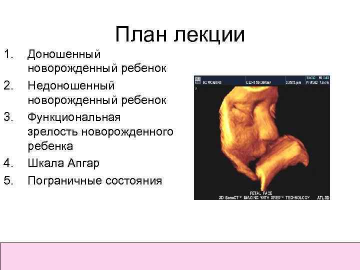 План лекции 1. 2. 3. 4. 5. Доношенный новорожденный ребенок Недоношенный новорожденный ребенок Функциональная