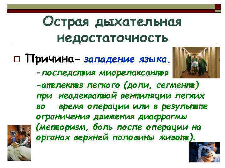 Острая дыхательная недостаточность o Причина- западение языка. -последствия миорелаксантов -ателектаз легкого (доли, сегмента) при