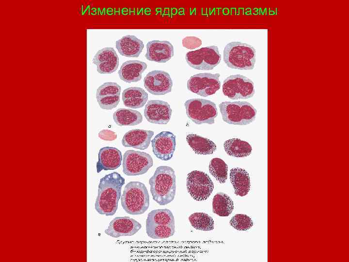 Изменение ядра и цитоплазмы 