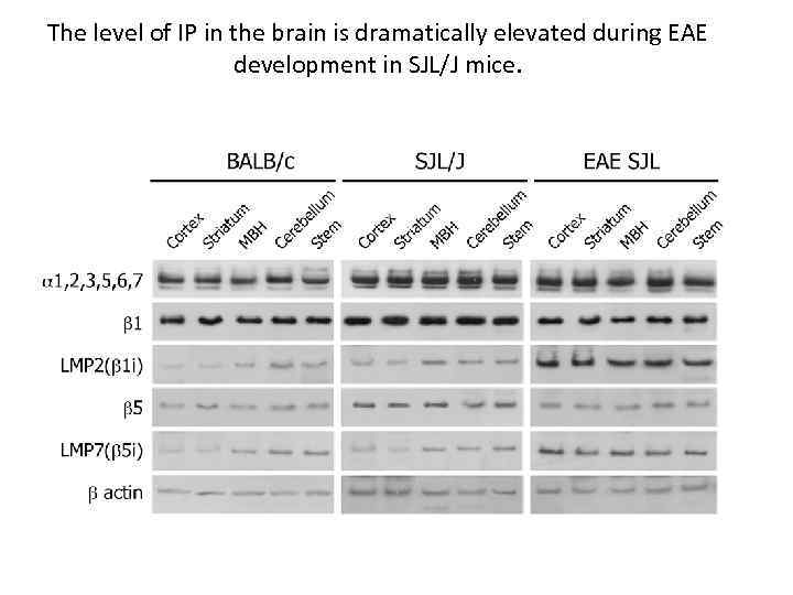 The level of IP in the brain is dramatically elevated during EAE development in