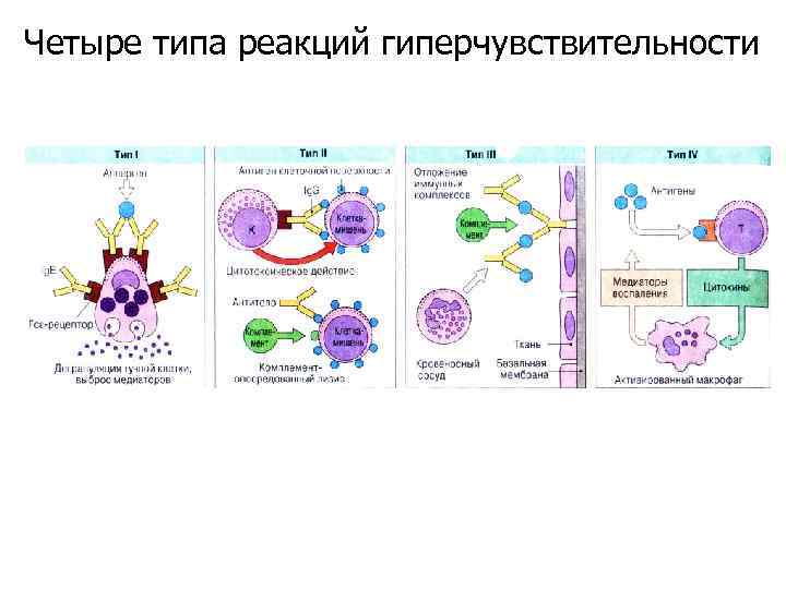 Четыре типа реакций гиперчувствительности 