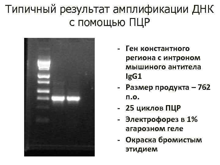 Типичный результат амплификации ДНК с помощью ПЦР - Ген константного региона с интроном мышиного