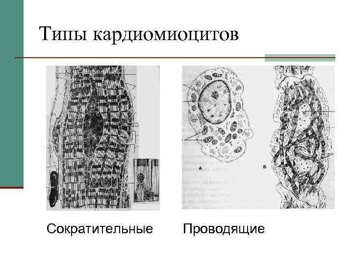 Атипичные кардиомиоциты рисунок