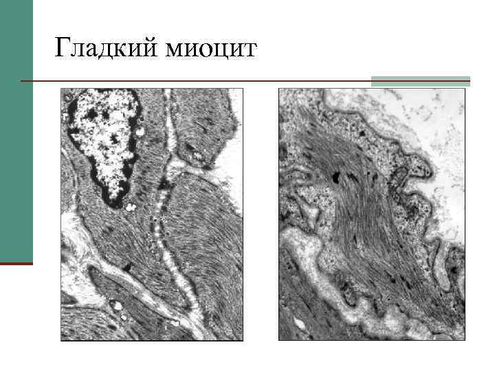 Гладкий миоцит 