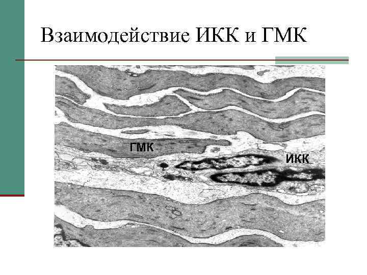 Взаимодействие ИКК и ГМК ИКК 