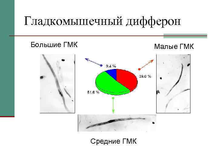 Гладкомышечный дифферон Большие ГМК Малые ГМК Средние ГМК 