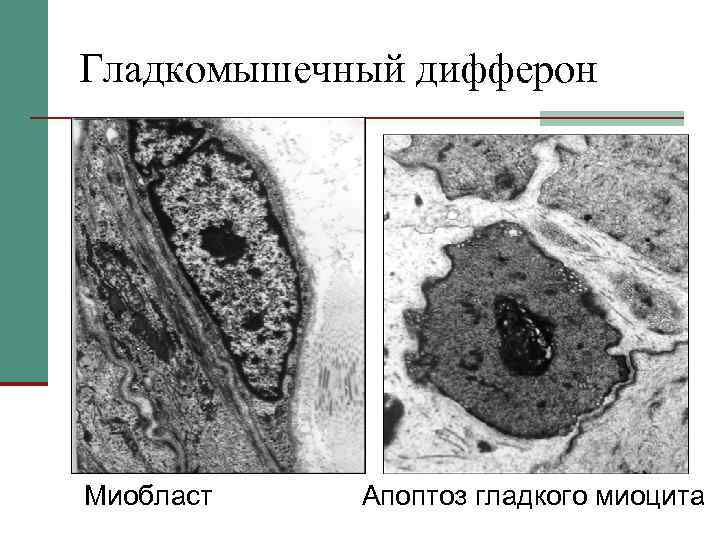 Гладкомышечный дифферон Миобласт Апоптоз гладкого миоцита 