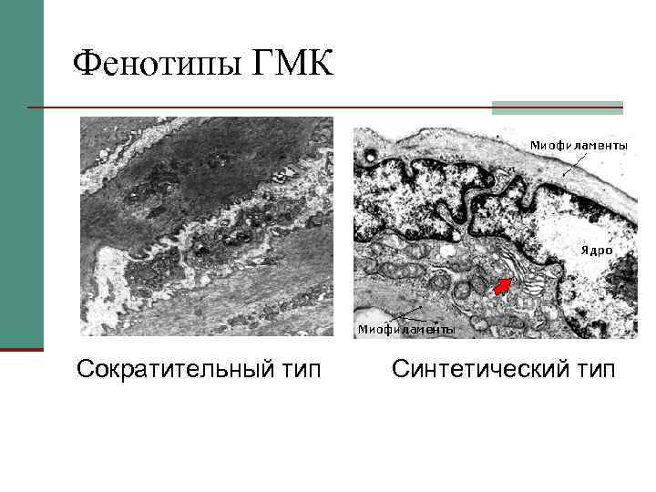 Фенотипы ГМК Сократительный тип Синтетический тип 