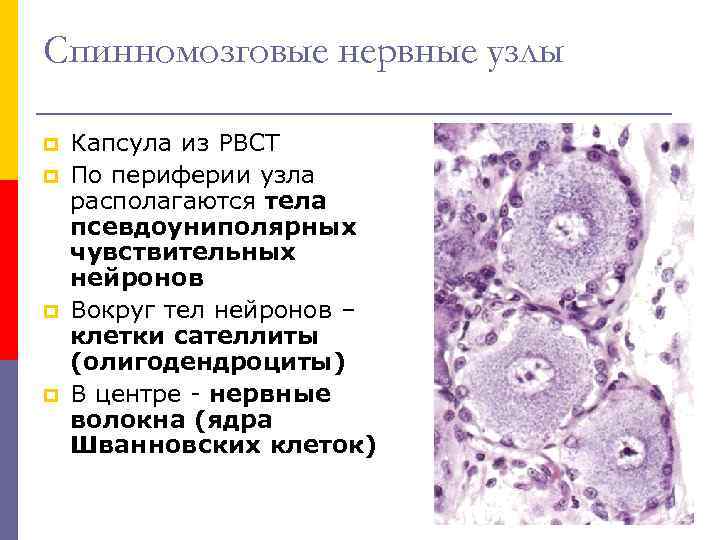 Спинномозговой узел гистология рисунок