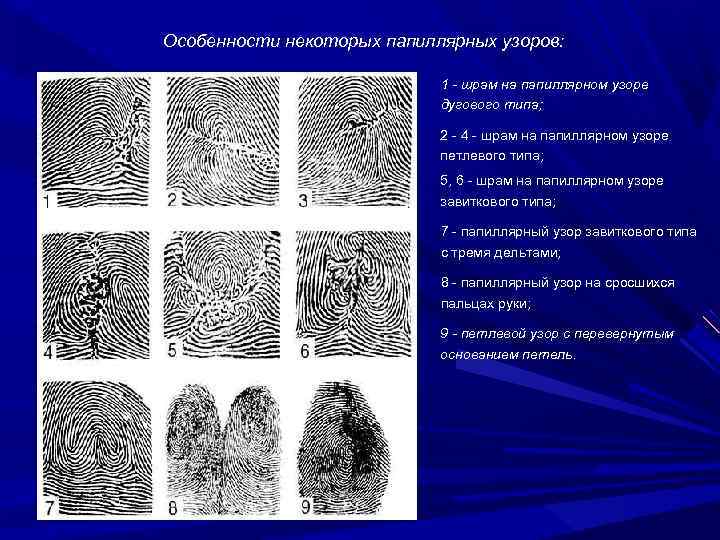 Чем обусловлен папиллярный рисунок кожи