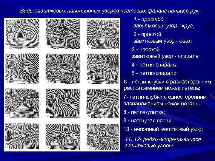 Установите соответствие рисунков ниже и изображенных на них типов папиллярных узоров