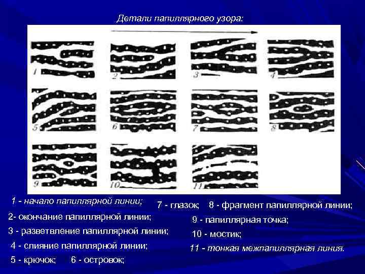 В коже пальца рисунок папиллярных линий определяется гистология