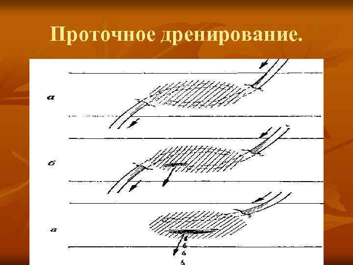 Проточное дренирование. 