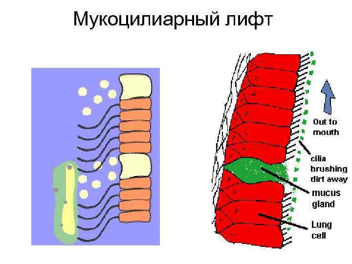 Мукоцилиарный лифт 