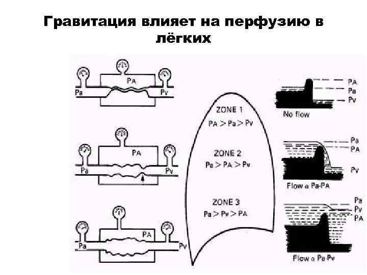 Гравитация влияет на перфузию в лёгких 