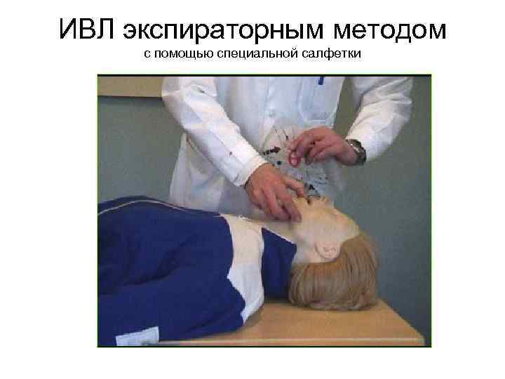 ИВЛ экспираторным методом с помощью специальной салфетки 