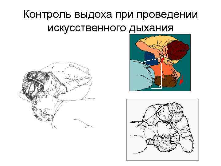 Контроль выдоха при проведении искусственного дыхания 