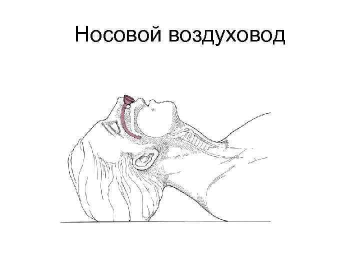 Носовой воздуховод 