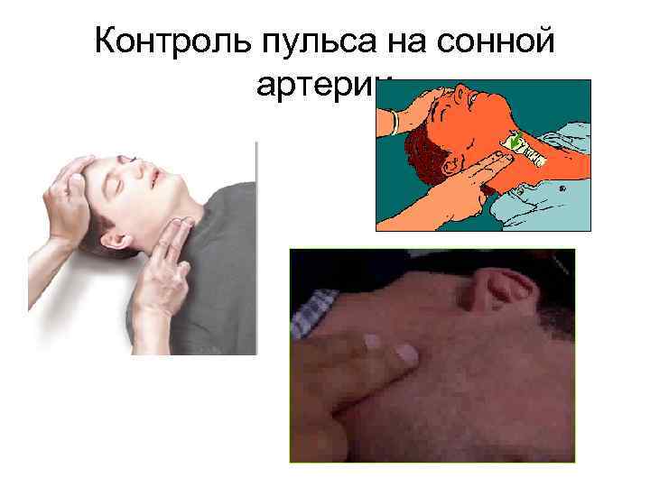 Контроль пульса на сонной артерии 
