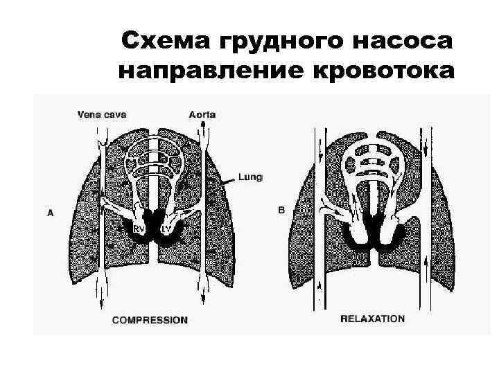 Схема грудного насоса направление кровотока 