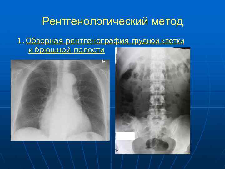 При рентгеноскопии изображение внутренних органов