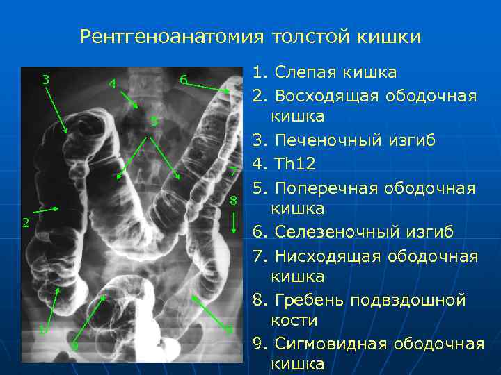 Лучевая диагностика жкт презентация